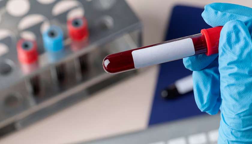 Important medical blood tests that your elderly needs